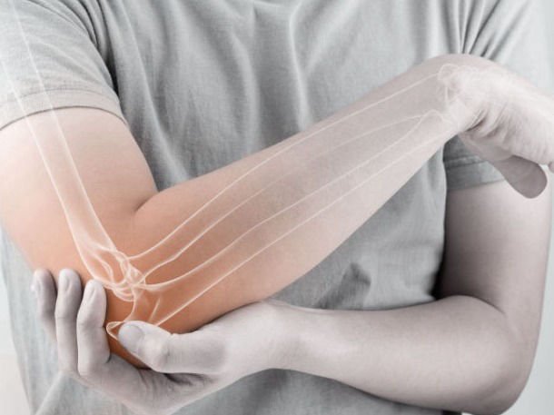 אוסטאופורוזיס